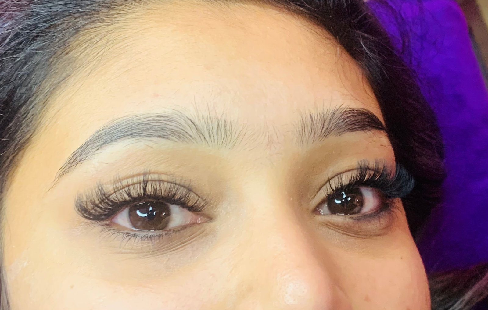 Skincare Treatment